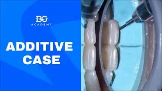Additive case