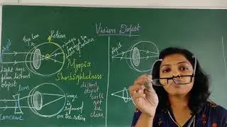 vision defect