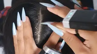 Heavy Flake Scalp Check ASMR 💆&zwj;♀️✨ | Slow Scratch Lines, Peeling & Deep Calm #VF0122