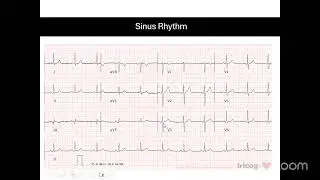 IMGN ECG TRAINING