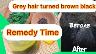 30 Days Challenge || Reverse Grey hair in black n brown Naturally and fast growth ||