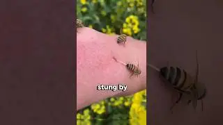 Что делать после укуса пчелы?! 🐝🚑😮
