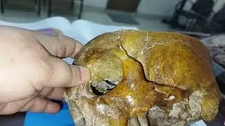 Exploring Norma Lateralis