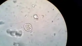 soil protozoon