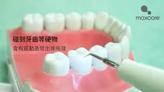 ION Sonic Tooth Cleaner 超聲波離子洗牙器
