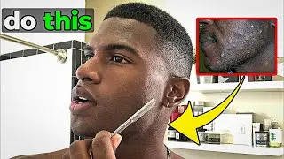 How to Actually Prevent Razor Bumps (and Treat Them)