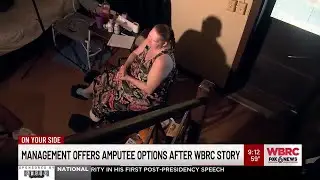 Management offers amputee options after WBRC story