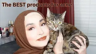 TROUBLED SKIN? My TOP recommendations for ACNE 🫧