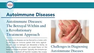Autoimmune Diseases (ऑटोइम्यून रोग) Treatment &ndash;Vision of Impossible to Possible&ndash;Dr Arpit Chopra Jain
