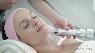 Tratamientos Faciales Segunda Parte en Medsthetik