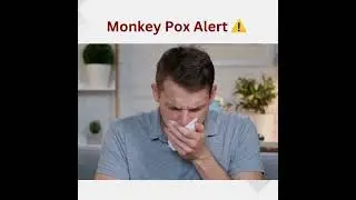 Monkeypox Alert: Essential Information for Staying Safe!