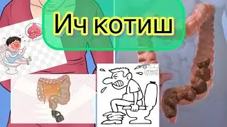 Ич котиш- ичнинг уз вактида келмаслиги йоки келишинг кийинлиги. Сабаблари, даволаш усуллари