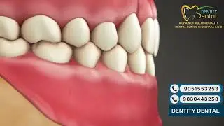 Anatomy of a Tooth Explained | Dentity Dental&rsquo;s Expert Guide to Your Smile
