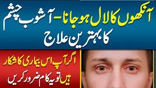 Ashob e Chashm or Ankhon Kay Lal hony Ka ilaj - Pink Eye (Conjunctivitis) Symptoms and Treatment
