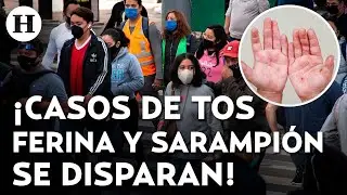 Aumento de casos de sarampión y tos ferina en México fue por desorden presupuestal, afirma experto