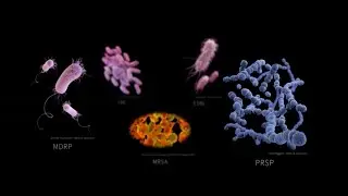 The Hidden Health Crisis of AMR
