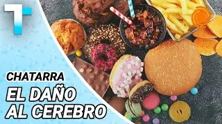 DATO SORPRENDENTE: &iquest;cu&aacute;nto tiempo tarda el cerebro en verse afectado por consumir comida chatarra?