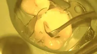 Injection molding using bioclear evolve matrix