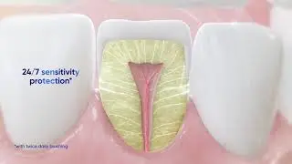 Sensodyne Clinical White MOA