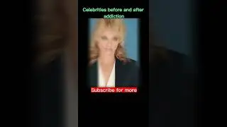 Celebrities Before and After Drugs Addiction😢 #shorts