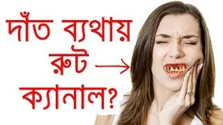 দাঁতের ব্যথায় রুট ক্যানাল কখন করাবেন ?