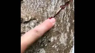 &ldquo;The sap from this Dragons Blood tree Follow&nbsp;@techforest7   #treemagic&nbsp;#sap&nbsp;#naturesmedicine&hellip;&rdquo; &bull; Ja
