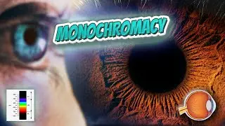 Monochromacy - Your EYEBALLS - EYNTK 👁️👁️💉😳💊🔊💯✅