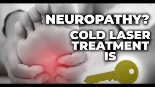Cold Laser Therapy for Neuropathy
