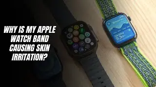 Why is my Apple Watch band causing skin irritation?