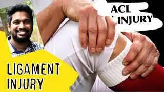 ligament injury | acl ligament tear | ligament injury malayalam
