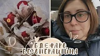Лазерна Блефаропластика ‼️Покупки Sinsay ‼️ Прибрала Ялинку