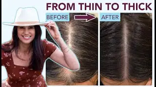Fully Vital hair growth products - testimonial from Lisa Williams