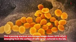 Coronavirus under microscope I Quan s&aacute;t Virus Corona dưới k&iacute;nh hiển vi