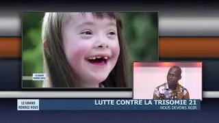 Lutte contre la trisomie 21 - Nous devons agir