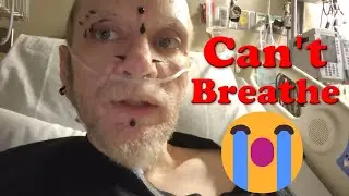 EMERGENCY ADMISSION TO HOSPITAL | Interstitual Lung Disease