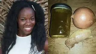 DIY onion ginger oil for fast hair growth and to eliminate Dandruff.