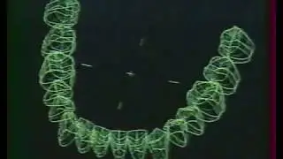 Emergence of Digital Dentistry & CAD/CAM Technology. Dr. Francois Duret. Beyond 2000. Australia.1987