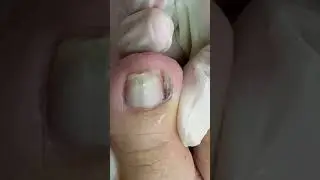 #satisfying #nails #satisfyingvideo #shortsvideo #short