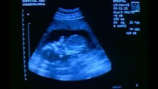 Amnesty International - Baby Girl (2006, Spain)