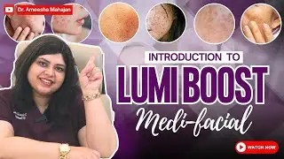 Don&rsquo;t Try Another Facial Until You See This! 😲 Introducing LumiBoost Medifacial #glow #pigmentation