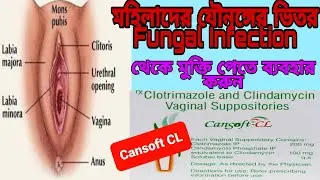 Cansoft-CL Vaginal Suppositories (Benefit, used, side effects),,,,সম্পূর্ণ বাংলা ভিডিও দেখুন।।।