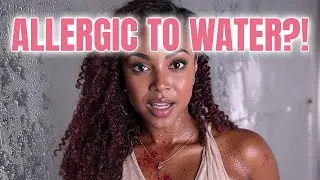 Weird Health News: Aquagenic Urticaria