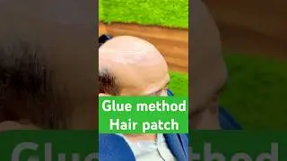 how to remove glue from hair patch, #reels #trending #wigs