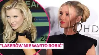 Joanna Krupa zrobiła zabieg na twarz, gdy miała 20 lat! 