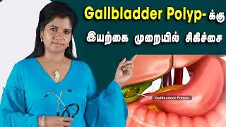 #gallbladderpolyp | Gallbladder Polyp காரணங்கள், அறிகுறிகள் மற்றும் சிகிச்சை முறை | Dr.B.YogaVidhya