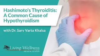 Hashimoto's Thyroiditis: A Common Cause of Hypothyroidism