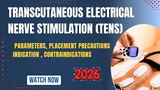 TENS Machine Use l Electrotherapy Modalities l Pain Relief l Chronic Pain l  Osteoarthritis