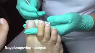 Voetbehandeling Medisch Pedicure Nanda van Spijker