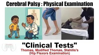 Thomas, Modified Thomas & Staheli Test Explained | Hip Flexion Contracture Examination in Pediatrics