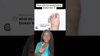 What a Foot Doctor Would Do For a Broken Toe #footdoc #podiatry #foothealth
